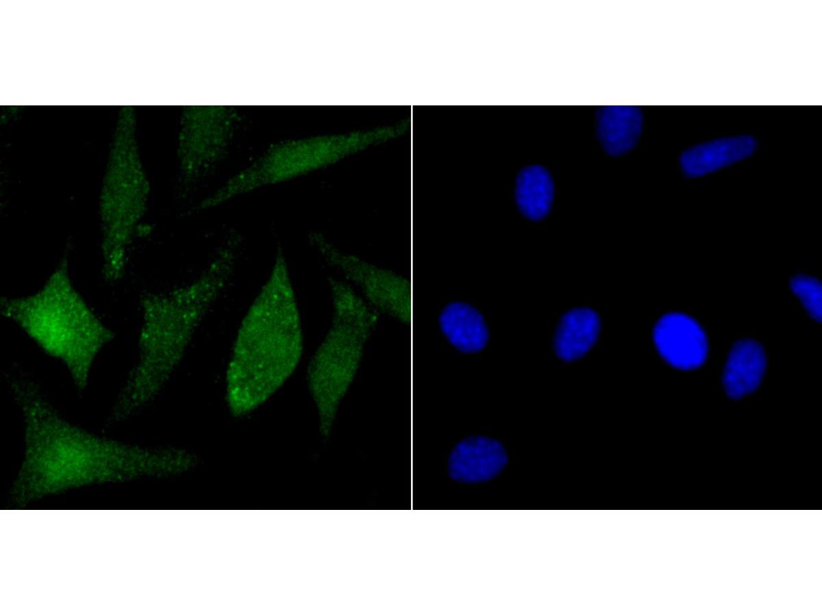 ICC staining PARP1 in SH-SY5Y cells (green). The nuclear counter stain is DAPI (blue). Cells were fixed in paraformaldehyde, permeabilised with 0.25% Triton X100/PBS.