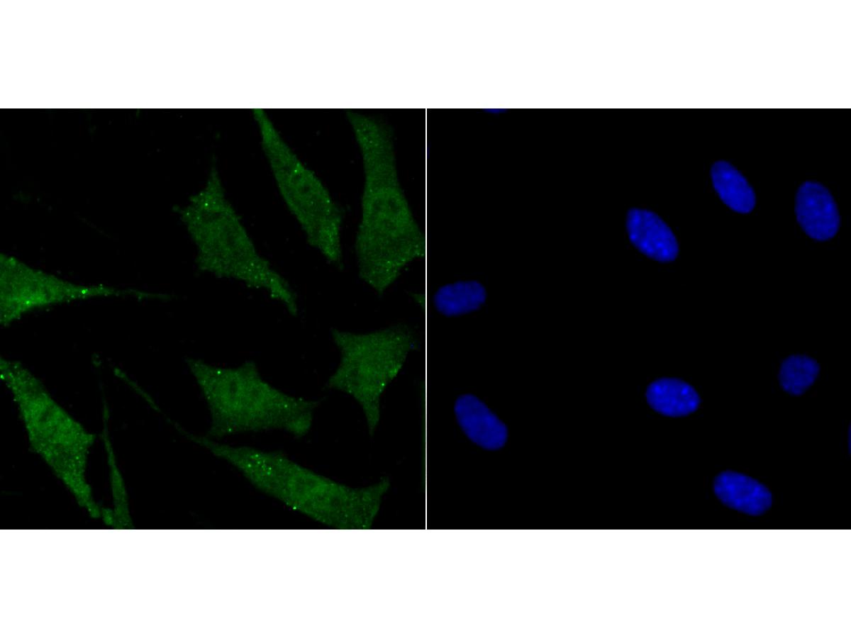 ICC staining SUFU in SH-SY-5Y cells (green). The nuclear counter stain is DAPI (blue). Cells were fixed in paraformaldehyde, permeabilised with 0.25% Triton X100/PBS.