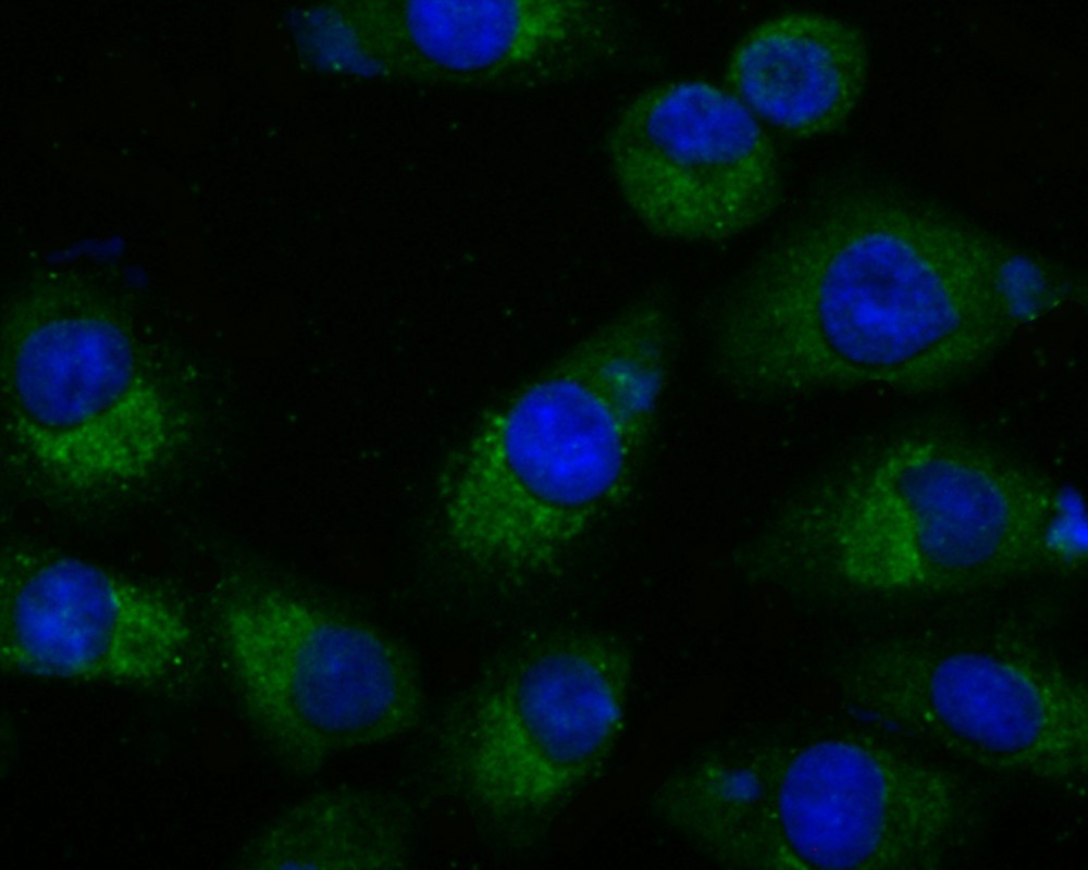 ICC staining SUFU in A549 cells (green). The nuclear counter stain is DAPI (blue). Cells were fixed in paraformaldehyde, permeabilised with 0.25% Triton X100/PBS.