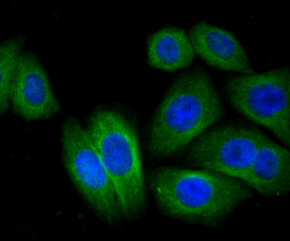 ICC staining CTGF in HepG2 cells (green). The nuclear counter stain is DAPI (blue). Cells were fixed in paraformaldehyde, permeabilised with 0.25% Triton X100/PBS.