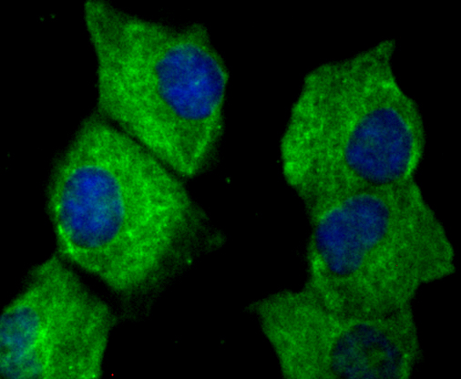 ICC staining CTGF in HUVEC cells (green). The nuclear counter stain is DAPI (blue). Cells were fixed in paraformaldehyde, permeabilised with 0.25% Triton X100/PBS.
