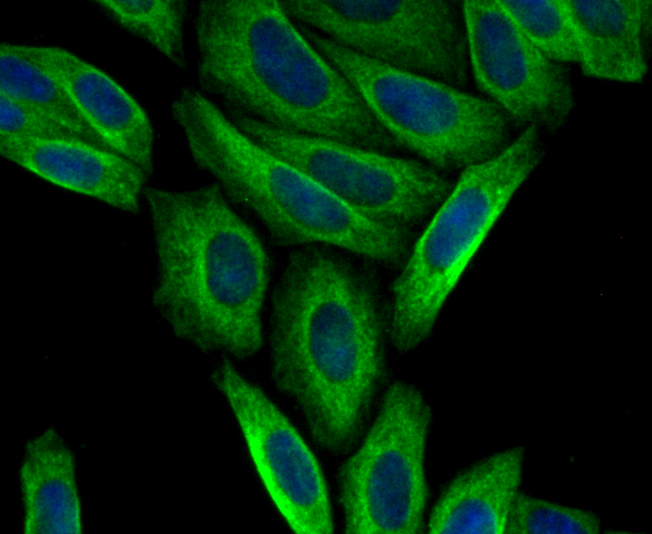 ICC staining CTGF in SiHa cells (green). The nuclear counter stain is DAPI (blue). Cells were fixed in paraformaldehyde, permeabilised with 0.25% Triton X100/PBS.
