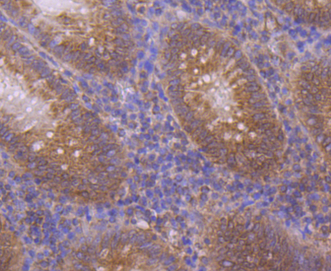 Immunohistochemical analysis of paraffin-embedded human appendix tissue using anti-CTGF antibody. Counter stained with hematoxylin.