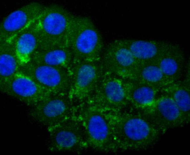 ICC staining CD36 in HepG2 cells (green). The nuclear counter stain is DAPI (blue). Cells were fixed in paraformaldehyde, permeabilised with 0.25% Triton X100/PBS.