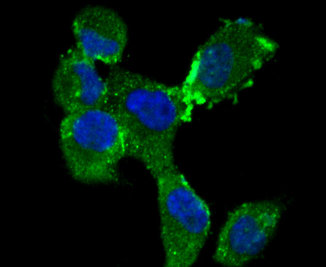 ICC staining CD36 in HUVEC cells (green). The nuclear counter stain is DAPI (blue). Cells were fixed in paraformaldehyde, permeabilised with 0.25% Triton X100/PBS.