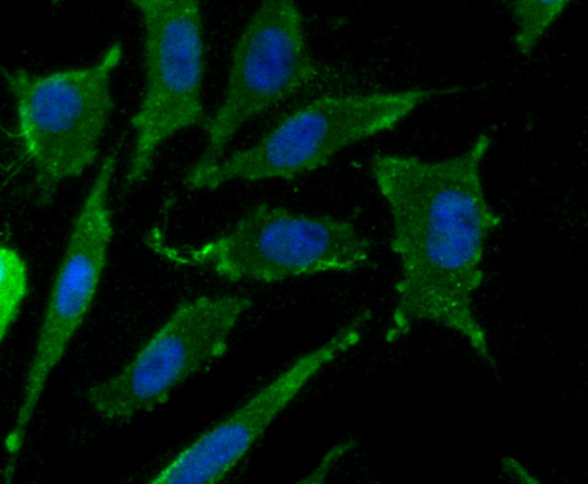 ICC staining CD36 in SH-SY5Y cells (green). The nuclear counter stain is DAPI (blue). Cells were fixed in paraformaldehyde, permeabilised with 0.25% Triton X100/PBS.