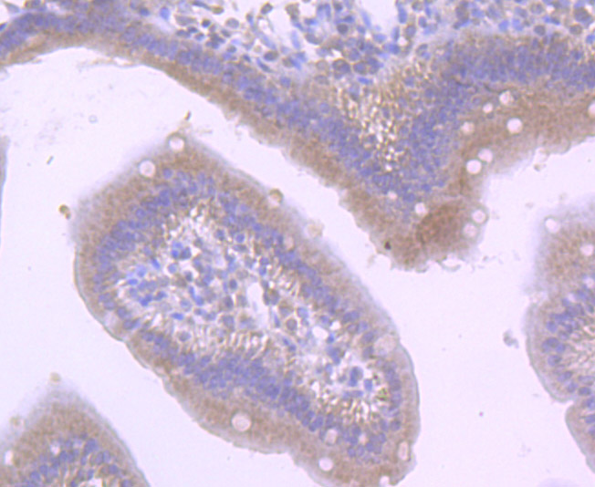 Immunohistochemical analysis of paraffin-embedded mouse small intestine tissue using anti-CD36 antibody. Counter stained with hematoxylin.
