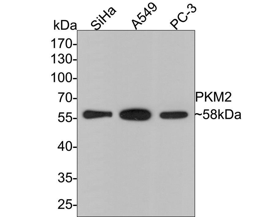 Western blot analysis of PKM2 on different lysates with Rabbit anti-PKM2 antibody (ER1802-70) at 1/500 dilution.<br />
<br />
Lane 1: SiHa cell lysate<br />
Lane 2: A549 cell lysate<br />
Lane 3: PC-3 cell lysate<br />
<br />
Lysates/proteins at 10 µg/Lane.<br />
<br />
Predicted band size: 58 kDa<br />
Observed band size: 58 kDa<br />
<br />
Exposure time: 2 minutes;<br />
<br />
10% SDS-PAGE gel.<br />
<br />
Proteins were transferred to a PVDF membrane and blocked with 5% NFDM/TBST for 1 hour at room temperature. The primary antibody (ER1802-70) at 1/500 dilution was used in 5% NFDM/TBST at room temperature for 2 hours. Goat Anti-Rabbit IgG - HRP Secondary Antibody (HA1001) at 1:300,000 dilution was used for 1 hour at room temperature.