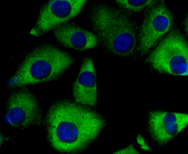 ICC staining PKM2 in A549 cells (green). The nuclear counter stain is DAPI (blue). Cells were fixed in paraformaldehyde, permeabilised with 0.25% Triton X100/PBS.