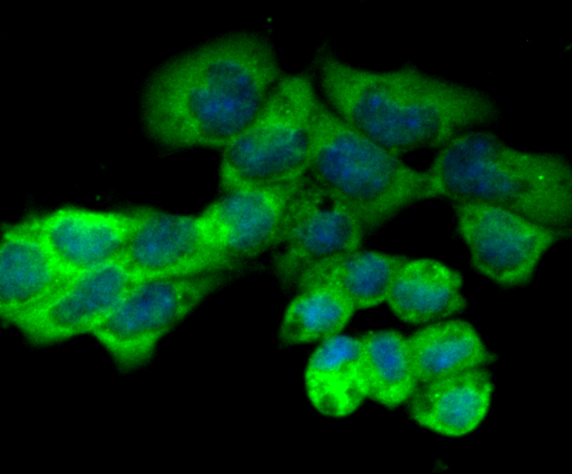 ICC staining PKM2 in F9 cells (green). The nuclear counter stain is DAPI (blue). Cells were fixed in paraformaldehyde, permeabilised with 0.25% Triton X100/PBS.