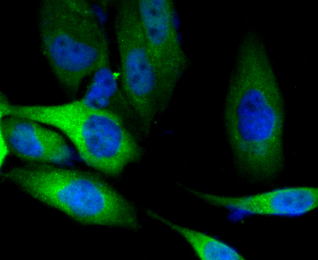 ICC staining PKM2 in PC-3M cells (green). The nuclear counter stain is DAPI (blue). Cells were fixed in paraformaldehyde, permeabilised with 0.25% Triton X100/PBS.