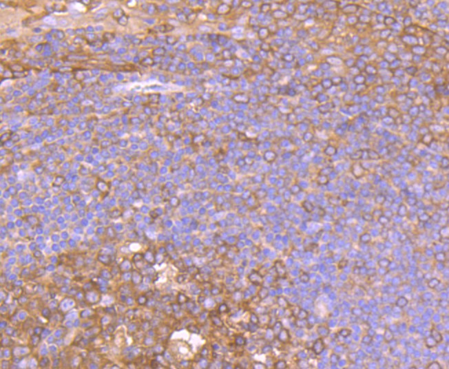 Immunohistochemical analysis of paraffin-embedded human tonsil tissue using anti-PKM2 antibody. Counter stained with hematoxylin.