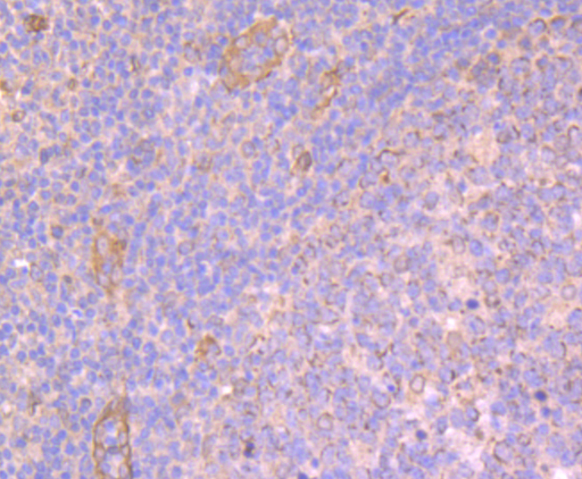 Immunohistochemical analysis of paraffin-embedded human tonsil tissue using anti-Apg3 antibody. Counter stained with hematoxylin.