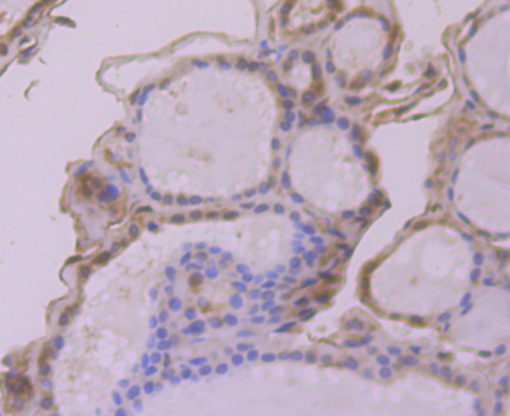 Immunohistochemical analysis of paraffin-embedded human thyroid gland tissue using anti-Apg3 antibody. Counter stained with hematoxylin.