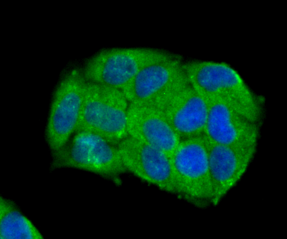 ICC staining Carbonic anhydrase 2 in Hela cells (green). The nuclear counter stain is DAPI (blue). Cells were fixed in paraformaldehyde, permeabilised with 0.25% Triton X100/PBS.