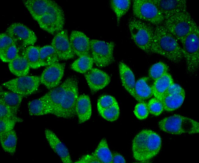 ICC staining Carbonic anhydrase 2 in LOVO cells (green). The nuclear counter stain is DAPI (blue). Cells were fixed in paraformaldehyde, permeabilised with 0.25% Triton X100/PBS.