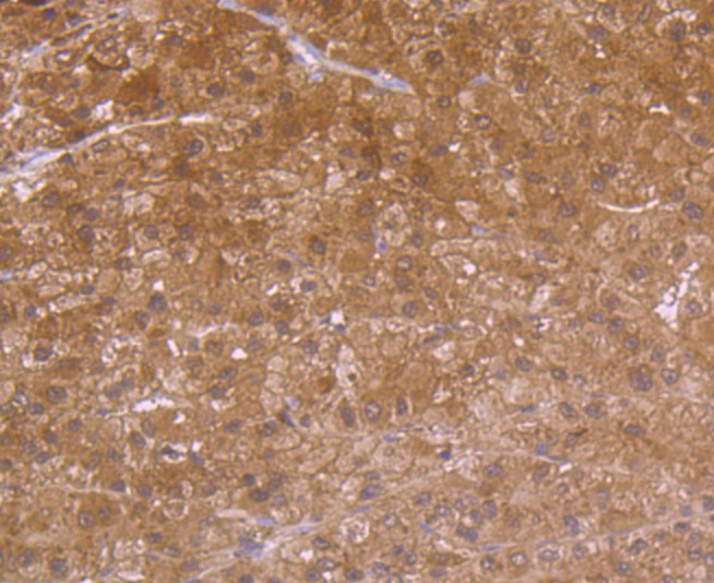 Immunohistochemical analysis of paraffin-embedded human liver tissue using anti-Carbonic anhydrase 2 antibody. Counter stained with hematoxylin.