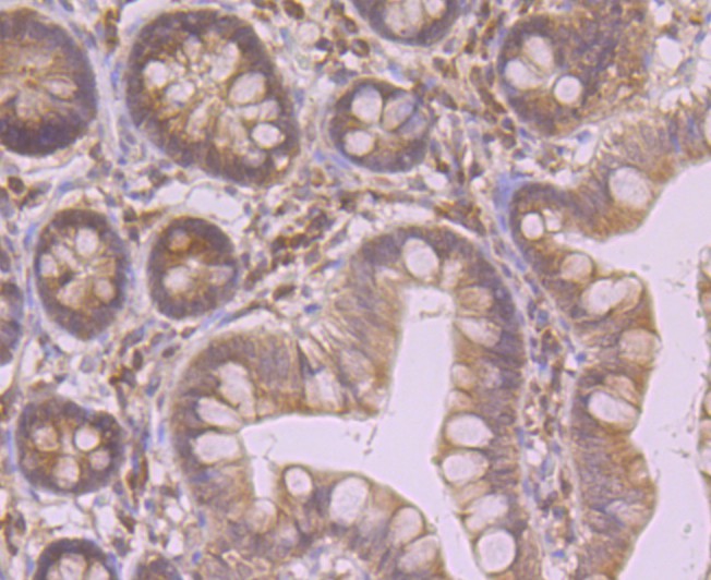 Immunohistochemical analysis of paraffin-embedded mouse small intestine tissue using anti-Heme Oxygenase 1 (HO-1) antibody. Counter stained with hematoxylin.
