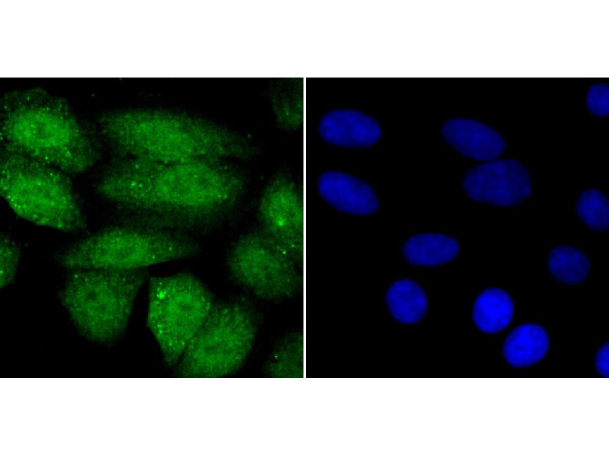 ICC staining SHP1 in HepG2 cells (green). The nuclear counter stain is DAPI (blue). Cells were fixed in paraformaldehyde, permeabilised with 0.25% Triton X100/PBS.