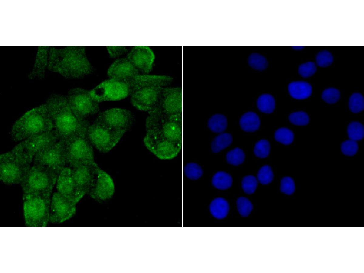 ICC staining SHP1 in LOVO cells (green). The nuclear counter stain is DAPI (blue). Cells were fixed in paraformaldehyde, permeabilised with 0.25% Triton X100/PBS.