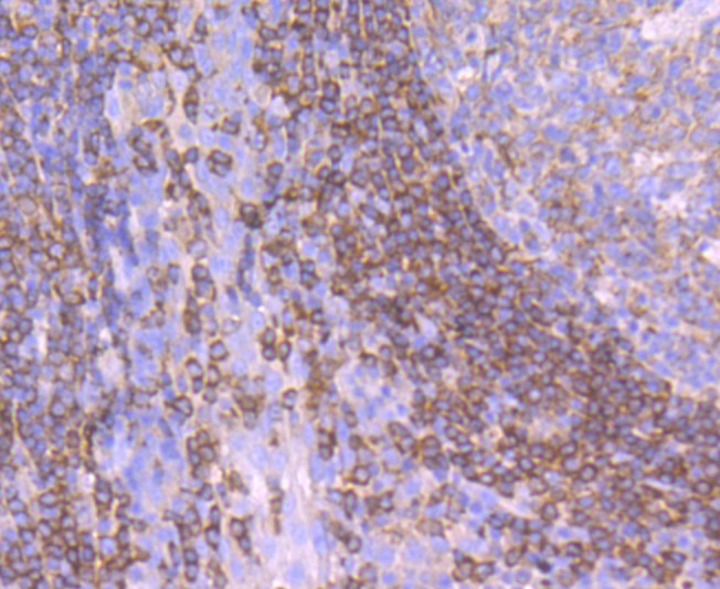 Immunohistochemical analysis of paraffin-embedded human tonsil tissue using anti- SHP1 antibody. Counter stained with hematoxylin.