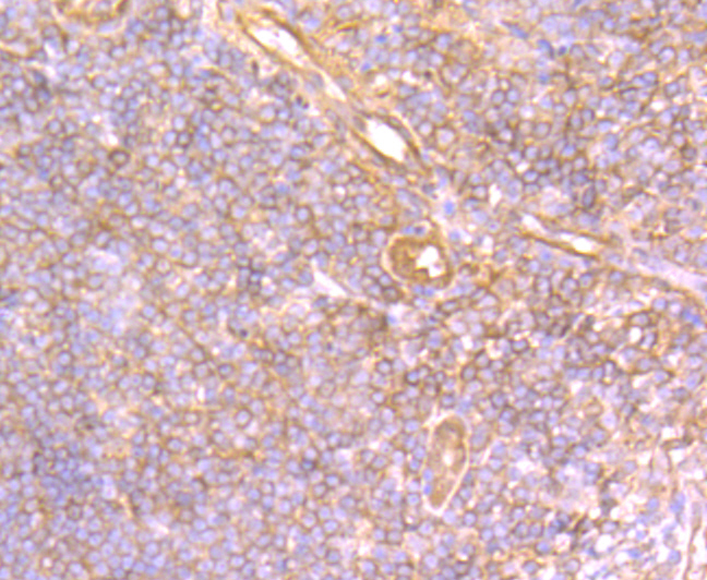 Immunohistochemical analysis of paraffin-embedded human tonsil tissue using anti-Securin antibody. Counter stained with hematoxylin.