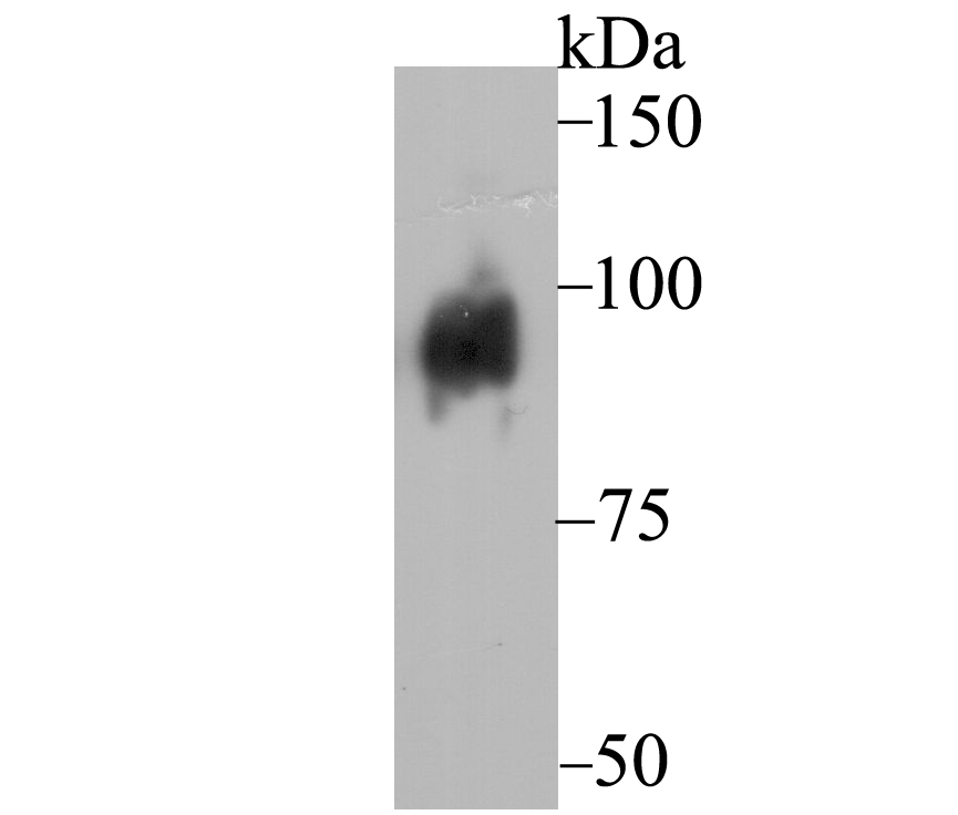 Western blot analysis of Dynamin 1 on mouse brain tissue lysate using anti-Dynamin 1 antibody at 1/500 dilution.