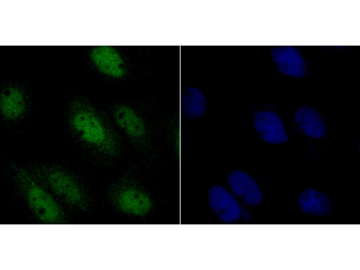 ICC staining RUNX2 in A431 cells (green). The nuclear counter stain is DAPI (blue). Cells were fixed in paraformaldehyde, permeabilised with 0.25% Triton X100/PBS.