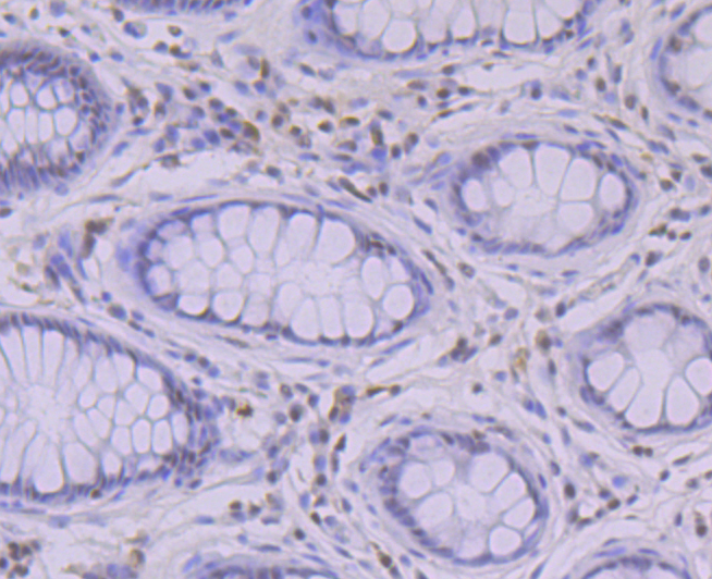 Immunohistochemical analysis of paraffin-embedded human colon tissue using anti-RUNX2 antibody. Counter stained with hematoxylin.