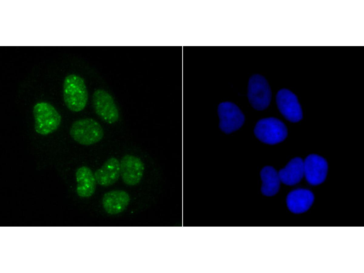 ICC staining Histone H3.1 in Hela cells (green). The nuclear counter stain is DAPI (blue). Cells were fixed in paraformaldehyde, permeabilised with 0.25% Triton X100/PBS.