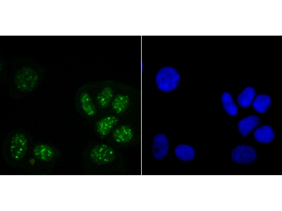 ICC staining Histone H3.1 in MCF-7 cells (green). The nuclear counter stain is DAPI (blue). Cells were fixed in paraformaldehyde, permeabilised with 0.25% Triton X100/PBS.