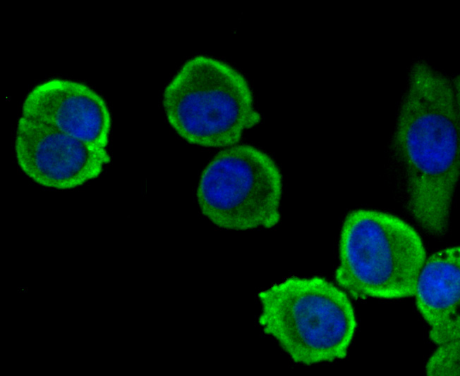 ICC staining EpCAM in MCF-7 cells (green). The nuclear counter stain is DAPI (blue). Cells were fixed in paraformaldehyde, permeabilised with 0.25% Triton X100/PBS.