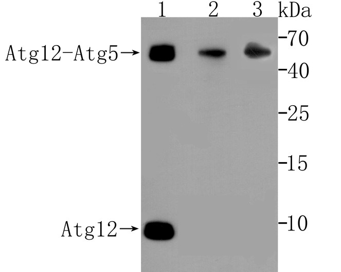 Western blot analysis of Atg12 on different lysates using anti-Atg12 antibody at 1/500 dilution.<br />
Positive control:<br />
Lane 1: A431 cell lysate<br />
Lane 2: Human kidney tissue lysate<br />
Lane 3: 293T cell lysate