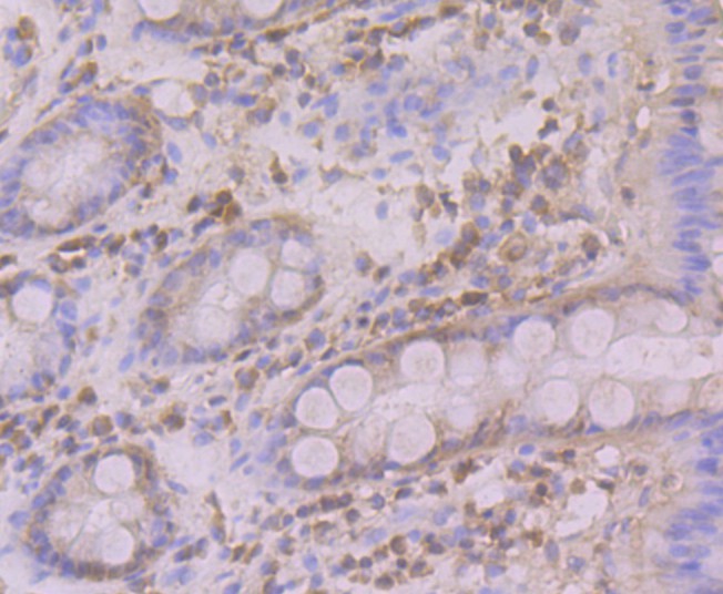 Immunohistochemical analysis of paraffin-embedded human colon tissue using anti-Atg12 antibody. Counter stained with hematoxylin.