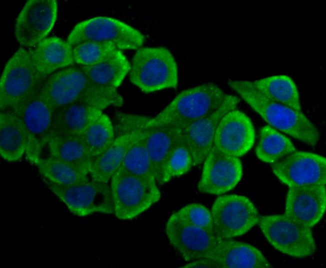 ICC staining PTP1B in HUVEC cells (green). The nuclear counter stain is DAPI (blue). Cells were fixed in paraformaldehyde, permeabilised with 0.25% Triton X100/PBS.