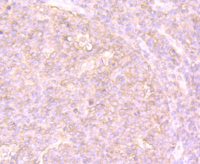 Immunohistochemical analysis of paraffin-embedded human tonsil tissue using anti-PTP1B antibody. Counter stained with hematoxylin.