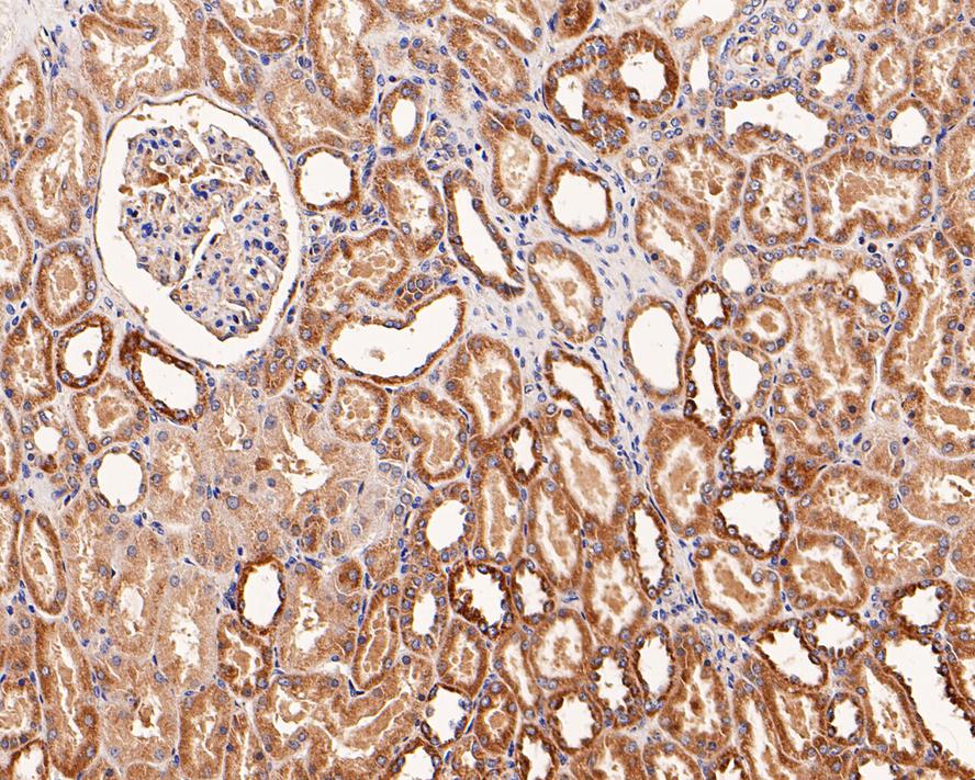 Immunohistochemical analysis of paraffin-embedded human kidney tissue with Rabbit anti-PTP1B antibody (ER1802-83) at 1/1,000 dilution.<br />
<br />
The section was pre-treated using heat mediated antigen retrieval with Tris-EDTA buffer (pH 9.0) for 20 minutes. The tissues were blocked in 1% BSA for 20 minutes at room temperature, washed with ddH2O and PBS, and then probed with the primary antibody (ER1802-83) at 1/1,000 dilution for 1 hour at room temperature. The detection was performed using an HRP conjugated compact polymer system. DAB was used as the chromogen. Tissues were counterstained with hematoxylin and mounted with DPX.