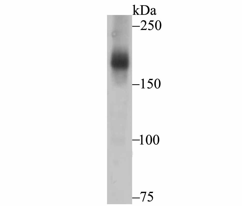 Western blot analysis of ASK1 on human skeletal muscle tissue lysate using anti-ASK1 antibody at 1/500 dilution.