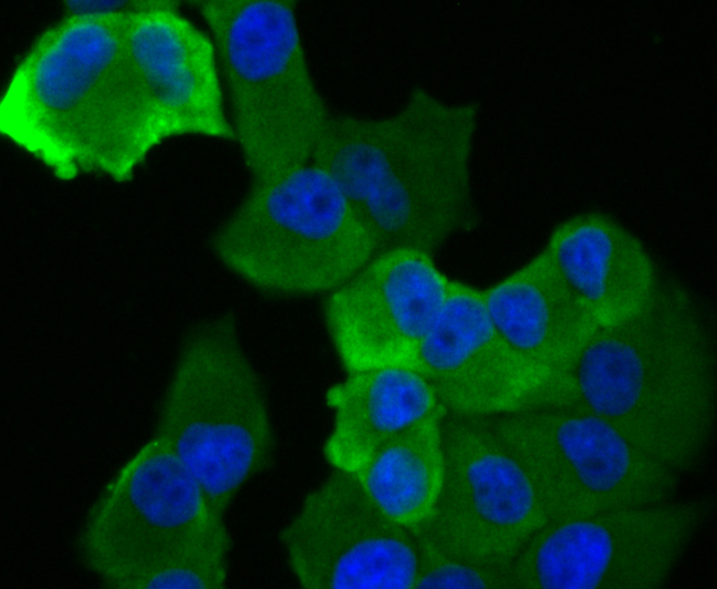 ICC staining ASK1 (green) in PANC-1 cells. The nuclear counter stain is DAPI (blue). Cells were fixed in paraformaldehyde, permeabilised with 0.25% Triton X100/PBS.