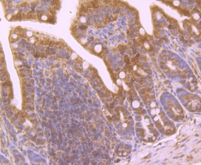 Immunohistochemical analysis of paraffin-embedded mouse colon tissue using anti-NQO1 antibody. Counter stained with hematoxylin.