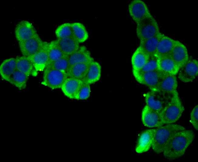 ICC staining BCHE in LOVO cells (green). The nuclear counter stain is DAPI (blue). Cells were fixed in paraformaldehyde, permeabilised with 0.25% Triton X100/PBS.