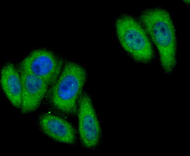 ICC staining BCHE in HepG2 cells (green). The nuclear counter stain is DAPI (blue). Cells were fixed in paraformaldehyde, permeabilised with 0.25% Triton X100/PBS.
