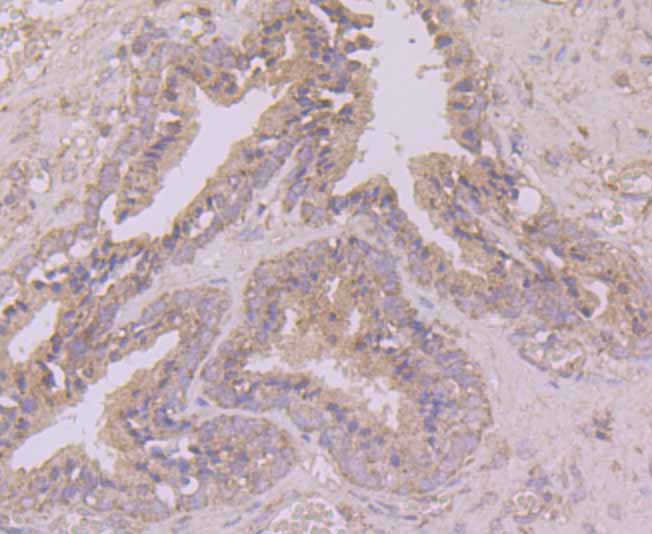 Immunohistochemical analysis of paraffin-embedded human prostate tissue using anti-BCHE antibody. Counter stained with hematoxylin.