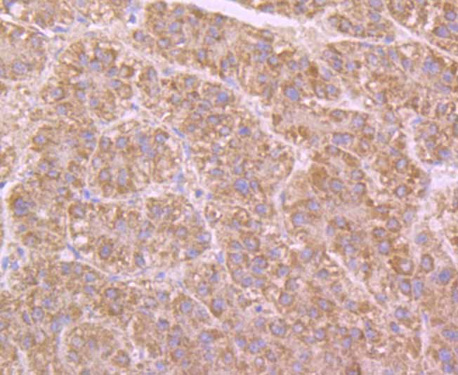 Immunohistochemical analysis of paraffin-embedded human liver tissue using anti-BCHE antibody. Counter stained with hematoxylin.