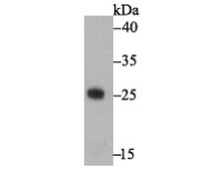 Western blot analysis of Enterotoxin A on recombinant protein lysate using anti-Enterotoxin A antibody at 1/1,000 dilution.
