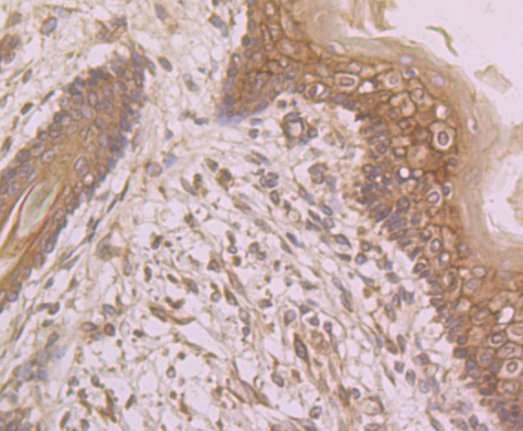 Immunohistochemical analysis of paraffin-embedded human skin tissue using anti-Connexin 43 antibody. Counter stained with hematoxylin.