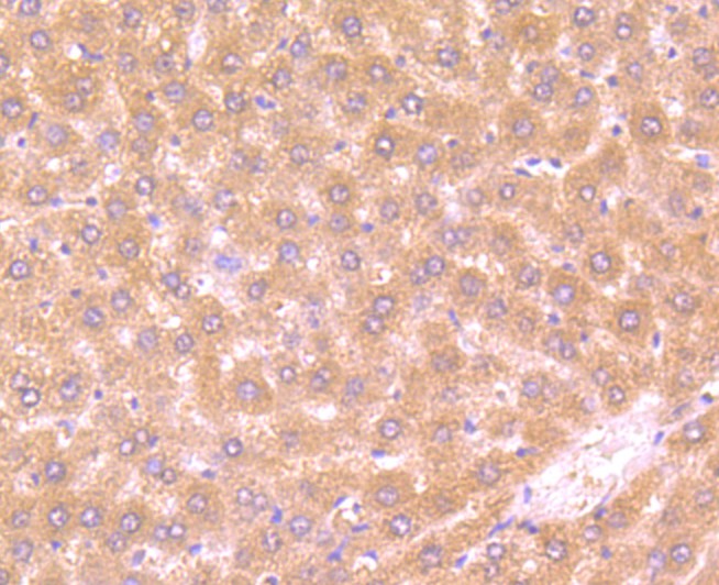 Immunohistochemical analysis of paraffin-embedded rat liver tissue using anti-FBXL18 antibody. Counter stained with hematoxylin.