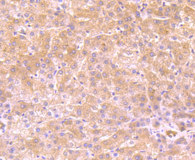 Immunohistochemical analysis of paraffin-embedded human liver tissue using anti-FBXL18 antibody. Counter stained with hematoxylin.