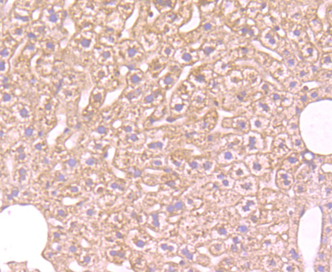 Immunohistochemical analysis of paraffin-embedded mouse liver tissue using anti-FBXL18 antibody. Counter stained with hematoxylin.