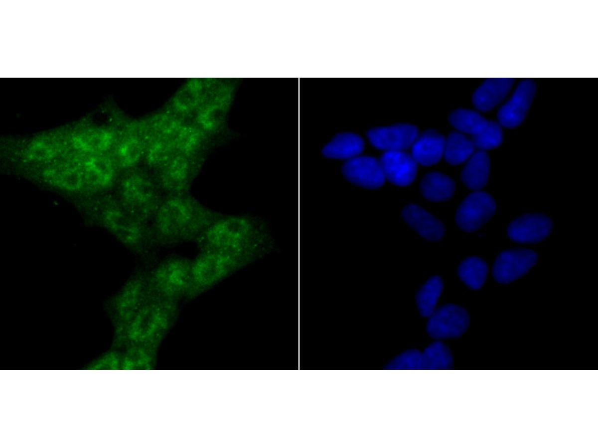 ICC staining RBX1 in 293T cells (green). The nuclear counter stain is DAPI (blue). Cells were fixed in paraformaldehyde, permeabilised with 0.25% Triton X100/PBS.